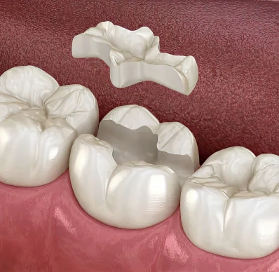 Restorative Dentist Near Me